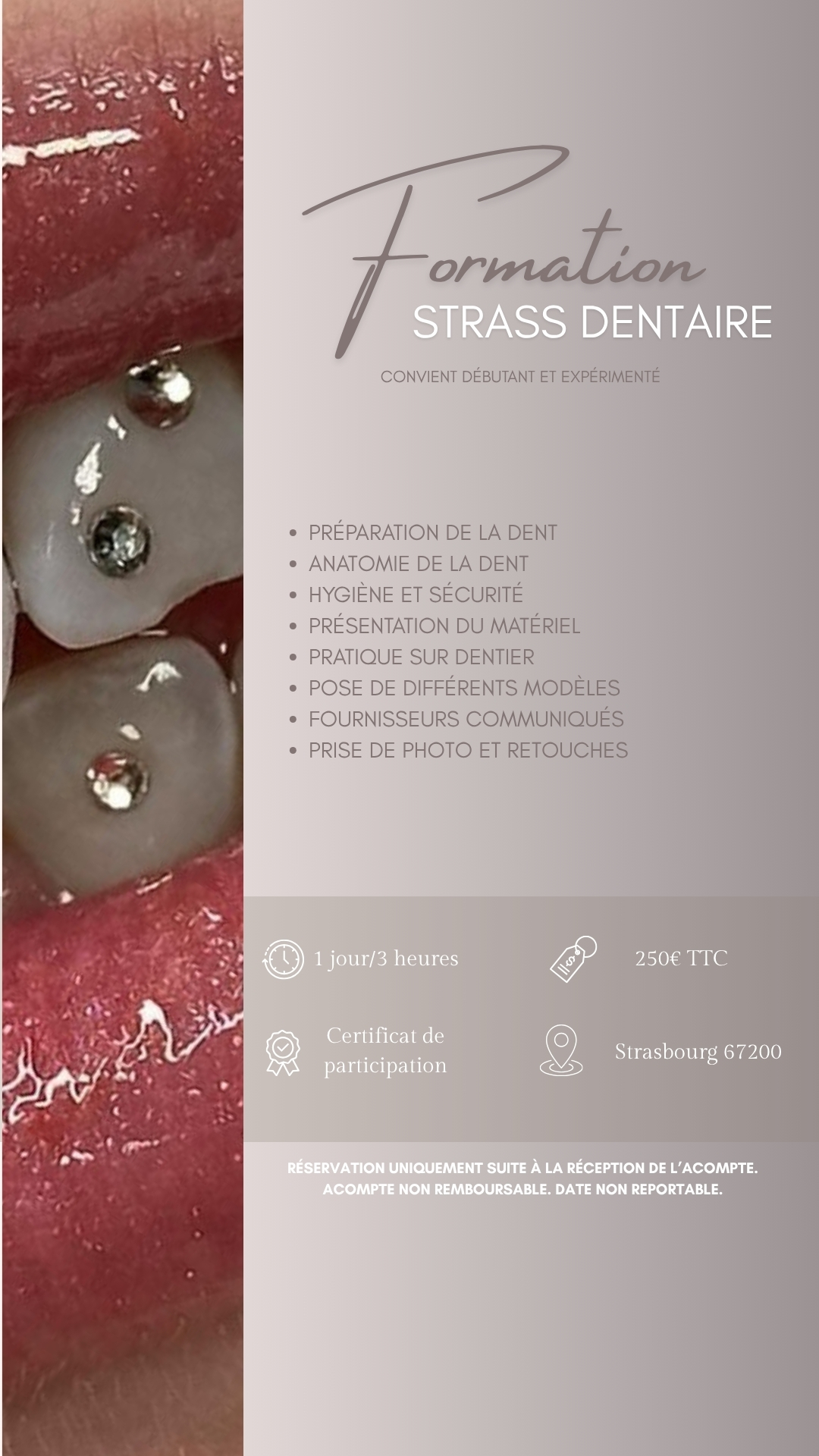 Formation Strass dentaire